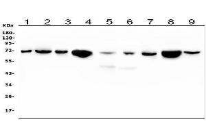 Western blot analysis of HSPA2 using anti-HSPA2 antibody (ABIN5692870). (HSPA2 Antikörper  (C-Term))