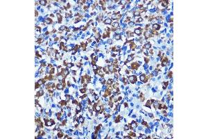 Immunohistochemistry of paraffin-embedded rat ovary using NEK2 Rabbit pAb  at dilution of 1:100 (40x lens). (NEK2 Antikörper  (C-Term))