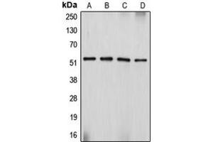 Western blot analysis of Desmin expression in Sol8 (A), HeLa (B), SJRH30 (C), PC12 (D) whole cell lysates. (Desmin Antikörper  (C-Term))