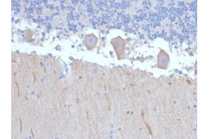 Formalin-fixed, paraffin-embedded human Brain stained with ATG5 Mouse Monoclonal Antibody (ATG5/2492). (ATG5 Antikörper  (AA 1-119))