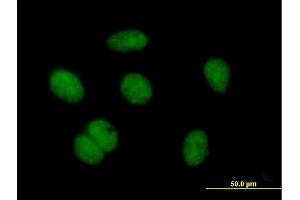 Immunofluorescence of purified MaxPab antibody to ZNF684 on HeLa cell. (ZNF684 Antikörper  (AA 1-378))
