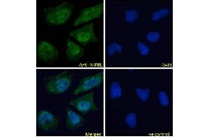 ABIN570861 Immunofluorescence analysis of paraformaldehyde fixed HeLa cells, permeabilized with 0. (NIPBL Antikörper  (AA 889-902))