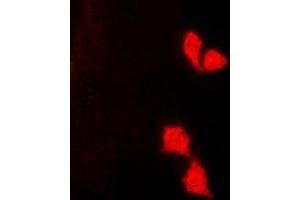Immunofluorescent analysis of HUS1 staining in K562 cells.