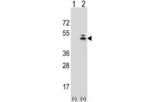 Western blot analysis of g-Actin antibody and 293 cell lysate (2 ug/lane) either nontransfected (Lane 1) or transiently transfected (2) with the ACTG1 gene. (Actin, gamma 1 Antikörper  (AA 188-215))
