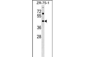 ZN Antibody (Center) (ABIN1538010 and ABIN2849144) western blot analysis in ZR-75-1 cell line lysates (35 μg/lane). (Zinc Finger and SCAN Domain Containing 31 (ZSCAN31) (AA 190-217) Antikörper)