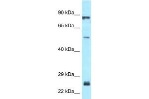 WB Suggested Anti-E2F1 Antibody Titration: 1. (E2F1 Antikörper  (Middle Region))