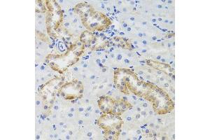 Immunohistochemistry of paraffin-embedded rat kidney using MTERFD3 antibody (ABIN5974877) at dilution of 1/100 (40x lens). (MTERFD3 Antikörper)