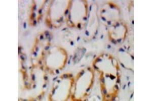 IHC-P analysis of Kidney tissue, with DAB staining. (PKN1 Antikörper  (AA 615-874))