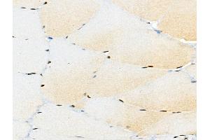 ABIN6256450 and ABIN6267096 at 1/100 staining Rat muscle tissue by IHC-P. (BCL9L Antikörper  (pSer915))