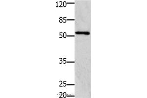 Western blot analysis of 293T cell, using GFRA1 Polyclonal Antibody at dilution of 1:1250 (GFRA1 Antikörper)