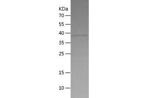Western Blotting (WB) image for Mitogen-Activated Protein Kinase Kinase Kinase 5 (MAP3K5) (AA 1180-1374) protein (His tag) (ABIN7124004) (ASK1 Protein (AA 1180-1374) (His tag))