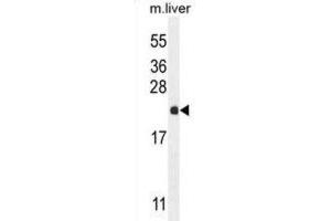 Western Blotting (WB) image for anti-Ribulose-5-Phosphate-3-Epimerase-Like (RPEL1) antibody (ABIN2995143) (Ribulose-5-Phosphate-3-Epimerase-Like (RPEL1) Antikörper)