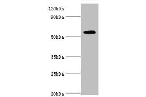 Western blot All lanes: TSEN2 antibody at 5 μg/mL + 293T whole cell lysate Secondary Goat polyclonal to rabbit IgG at 1/10000 dilution Predicted band size: 54, 52, 50, 48, 46 kDa Observed band size: 54 kDa (TSEN2 Antikörper  (AA 1-220))