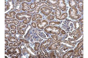 IHC-P Image MCD antibody [N2C1], Internal detects MCD protein at cytosol on mouse kidney by immunohistochemical analysis. (MLYCD Antikörper)