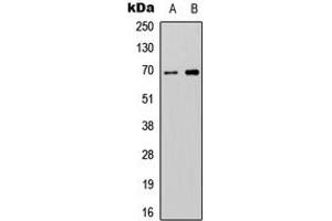 Western blot analysis of ATG16L2 expression in SHSY5Y (A), NIH3T3 (B) whole cell lysates. (ATG16L2 Antikörper  (Center))