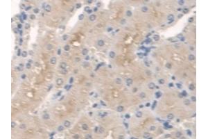 Detection of SPTLC1 in Mouse Kidney Tissue using Polyclonal Antibody to Serine Palmitoyltransferase, Long Chain Base Subunit 1 (SPTLC1) (SPTLC1 Antikörper  (AA 143-473))