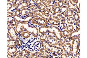 Immunohistochemistry analysis of paraffin-embedded Mouse kidney cancer using COX4I1 Polyclonal Antibody at dilution of 1:200. (COX IV Antikörper)