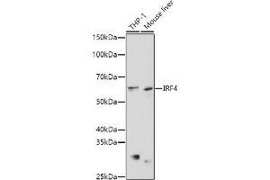 Western blot analysis of extracts of various cell lines, using IRF4 antibody (ABIN1680506, ABIN3015186, ABIN3015187 and ABIN6213873) at 1:1000 dilution. (IRF4 Antikörper  (AA 150-350))