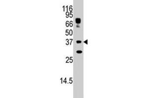 The STUB1 polyclonal antibody  is used in Western blot to detect STUB1 in HepG2 cell lysate. (STUB1 Antikörper  (AA 160-190))