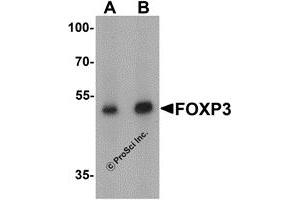 Western Blotting (WB) image for anti-Forkhead Box P3 (FOXP3) (C-Term) antibody (ABIN1077427) (FOXP3 Antikörper  (C-Term))