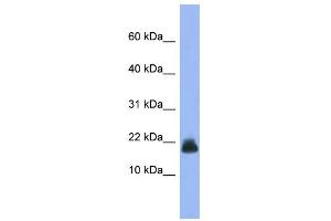 WB Suggested Anti-Cst6 Antibody Titration: 0.