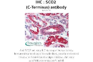 Image no. 1 for anti-SCO2 Cytochrome C Oxidase Assembly Protein (SCO2) antibody (ABIN1739069) (SCO2 Antikörper)
