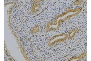 ABIN6277522 at 1/100 staining Human uterus tissue by IHC-P. (SERPINE2 Antikörper  (C-Term))