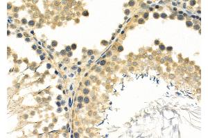 ABIN6261792 and ABIN6266895 at 1/100 staining Rat testis tissue by IHC-P. (FOXJ3 Antikörper  (C-Term))