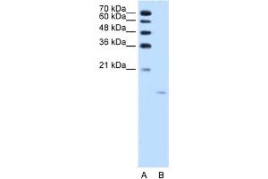 WB Suggested Anti-ACP1 Antibody Titration:  1.