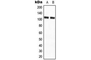 Western blot analysis of CCP2 expression in HepG2 (A), NIH3T3 (B) whole cell lysates. (AGBL2 Antikörper  (C-Term))