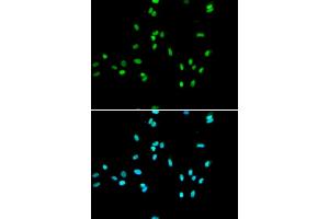 Immunofluorescence analysis of A549 cells using NR5A2 antibody (ABIN5973388). (NR5A2 + LRH1 Antikörper)