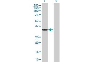 SULT1A3 Antikörper  (AA 1-295)