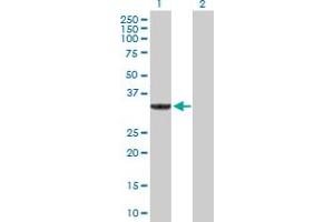 Western Blot analysis of SULT1A3 expression in transfected 293T cell line by SULT1A3 MaxPab polyclonal antibody.