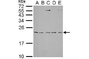 Western Blotting (WB) image for anti-Interleukin 1 Receptor Antagonist (IL1RN) antibody (ABIN2856394)