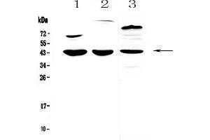 Western blot analysis of IL18 binding protein using anti-IL18 binding protein antibody .
