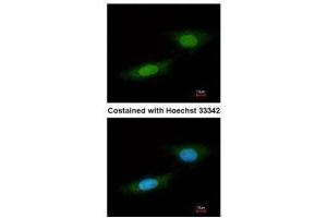 ICC/IF Image Immunofluorescence analysis of paraformaldehyde-fixed HeLa, using NLK, antibody at 1:100 dilution. (Nemo-Like Kinase Antikörper)