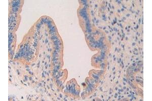 Used in DAB staining on fromalin fixed paraffin- embedded testis tissue (LAMa4 Antikörper  (AA 457-630))