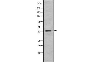 Western Blotting (WB) image for anti-Wingless-Type MMTV Integration Site Family, Member 10B (WNT10B) (Internal Region) antibody (ABIN6266030)