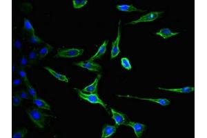 Immunofluorescent analysis of Hela cells using ABIN7147190 at dilution of 1:100 and Alexa Fluor 488-congugated AffiniPure Goat Anti-Rabbit IgG(H+L) (CD9 Antikörper  (AA 112-195))