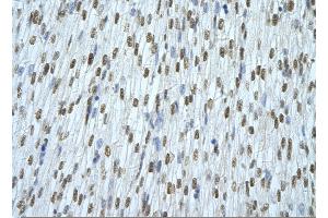 Rabbit Anti-HNRNPAB Antibody       Paraffin Embedded Tissue:  Human cardiac cell   Cellular Data:  Epithelial cells of renal tubule  Antibody Concentration:   4.