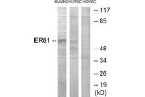 Western blot analysis of extracts from HuvEc cells, treated with PMA 125ng/ml 30', using ER81 Antibody. (ETV1 Antikörper  (AA 10-59))