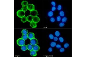 Immunofluorescence staining of fixed K562 cells with anti-CD43 antibody 84-3C1. (Rekombinanter CD43 Antikörper)