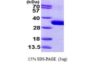 SDS-PAGE (SDS) image for Shwachman-Bodian-Diamond Syndrome (SBDS) (AA 1-250) protein (His tag) (ABIN667248) (SBDS Protein (AA 1-250) (His tag))