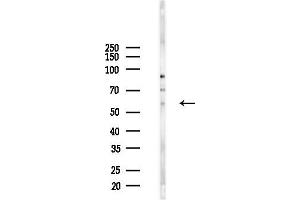 anti-serine/arginine-Rich Protein Specific Kinase 3 (SRPK3) (Internal Region) antibody