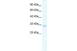 WB Suggested Anti-CLIC2 Antibody Titration:  1. (CLIC2 Antikörper  (C-Term))