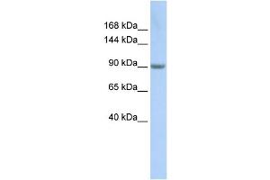 WB Suggested Anti-MARS Antibody Titration:  0.