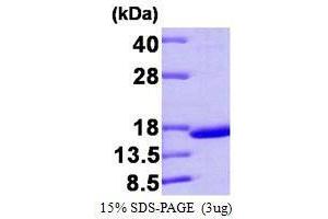 Figure annotation denotes ug of protein loaded and % gel used. (Transthyretin (TTR) (AA 21-147) Peptid)