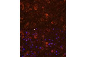 Immunofluorescence analysis of NIH/3T3 cells using FGF17 Rabbit pAb (ABIN7267183) at dilution of 1:150 (40x lens). (FGF17 Antikörper  (AA 23-180))