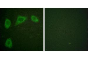 Immunofluorescence analysis of HuvEc cells, using Caveolin-1 antibody. (Caveolin-1 Antikörper)