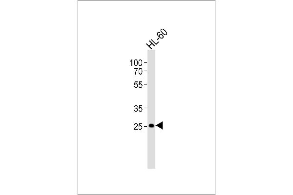 FCGR3B Antikörper  (N-Term)
